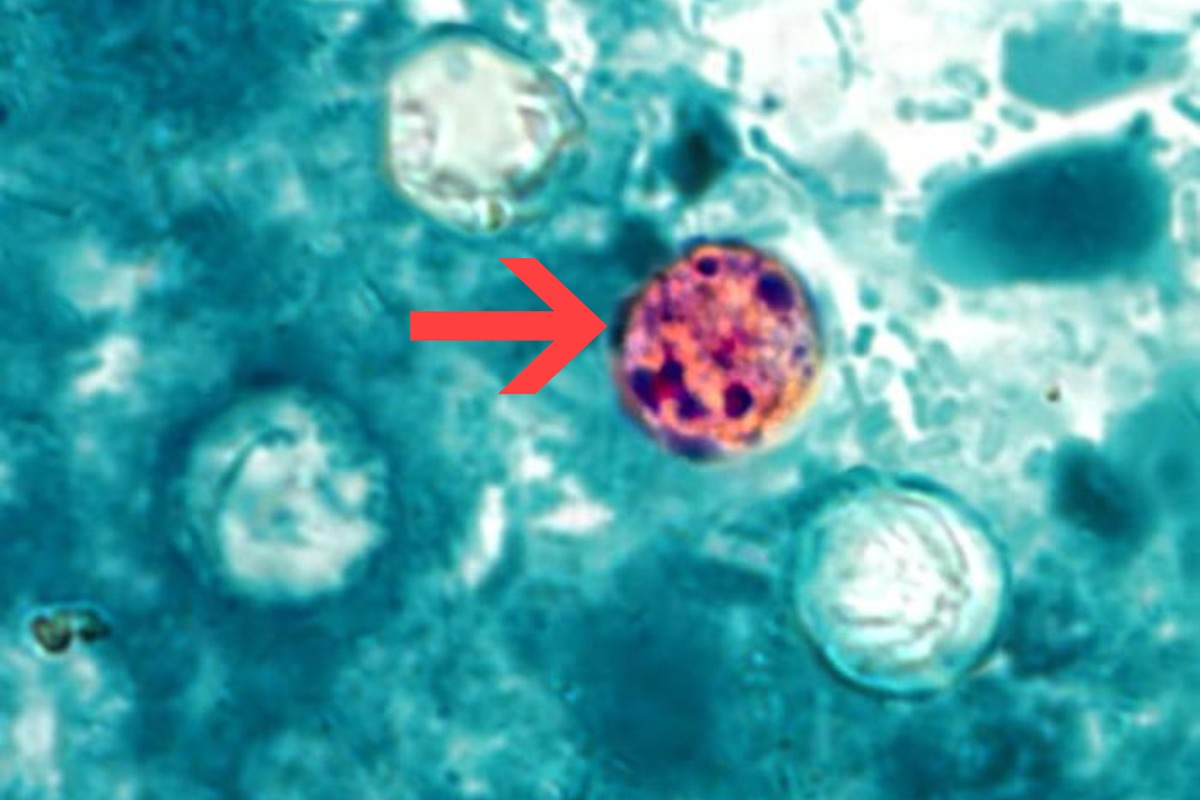 Cyclospora cayetanensis oocyst stained pink among unstained cells, marked by an arrow